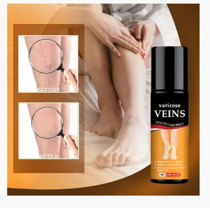 Fito™ Varicose & Spider Vein Spray | Natural Herbal Therapy for Swelling, Fatigue & Vein Health (Pack of 2)