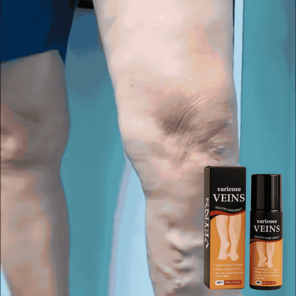 Fito™ Varicose & Spider Vein Spray | Natural Herbal Therapy for Swelling, Fatigue & Vein Health (Pack of 2)